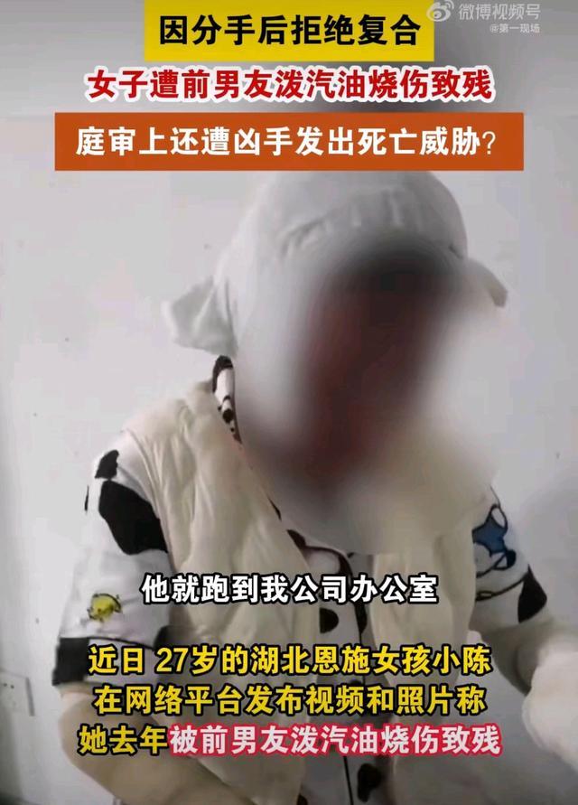 27岁女子被烧伤庭审遭前男友死亡威胁